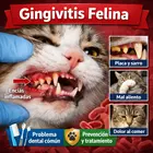 Gingivitis